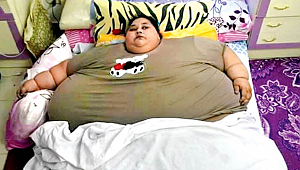 YARIM TONLUK MISIRLI KADINI AMELİYAT EDECEK