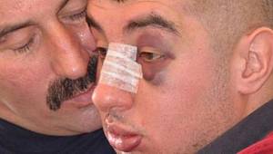 Zihinsel engelli genci döven serbest bırakıldı