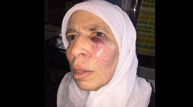 Sosyal medyada tartışma yaratan görüntüye emniyetten açıklama geldi