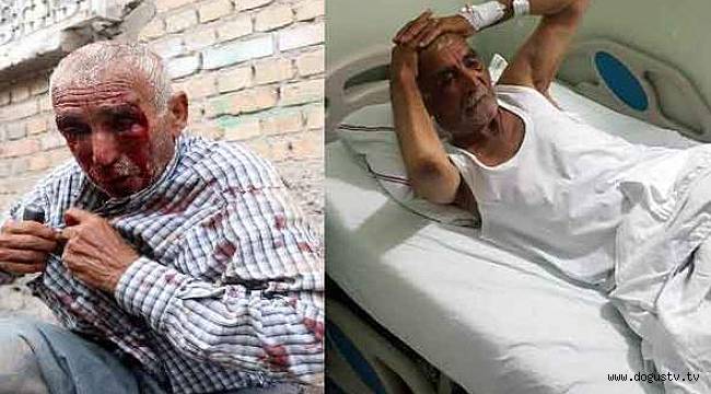 Adana’da dövülen 77 yaşındaki tarım işçisine sahip çıktılar