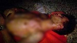 Adapazarı'nda korkunç olay! Selfie yaktı...