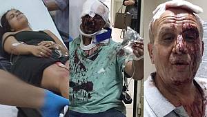 Kardeşlerin miras kavgası: 5 yaralı