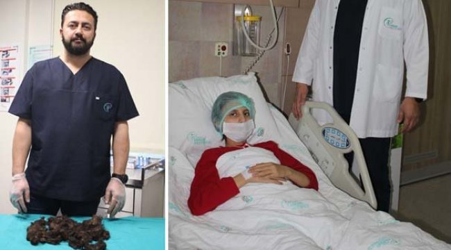 12 yaşındaki kızın midesinden top büyüklüğünde saç ve sakız yumağı çıkarıldı