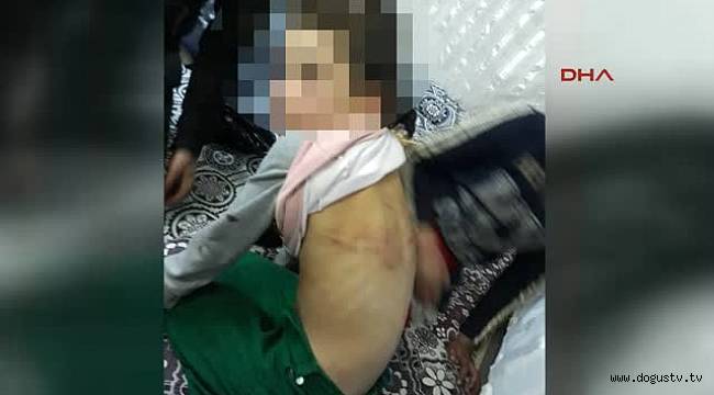 Babasından İşkence Gören Suriyeli Kız, Devlet Korumasına Alındı
