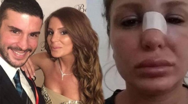 Berk Oktay'ın eşi Merve Şarapçıoğlu: Kocam beni dövdü, yardım edin!