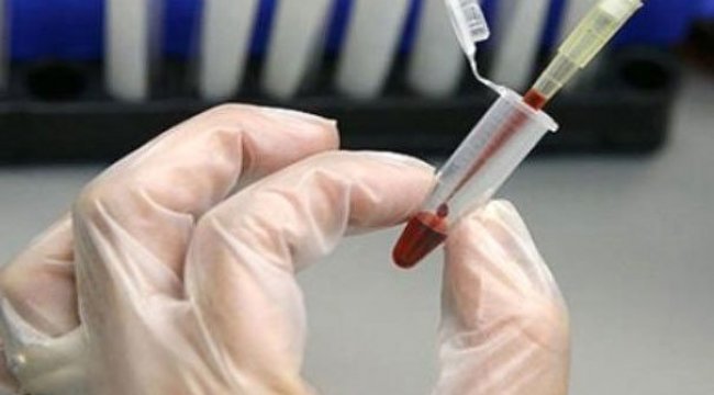 Yerli kanser ilacı için düğmeye basıldı