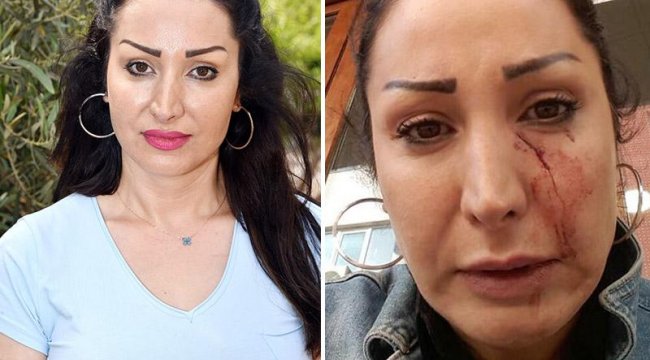 'Patatesi değiştir' dedi, garson yüzüne bıçak attı