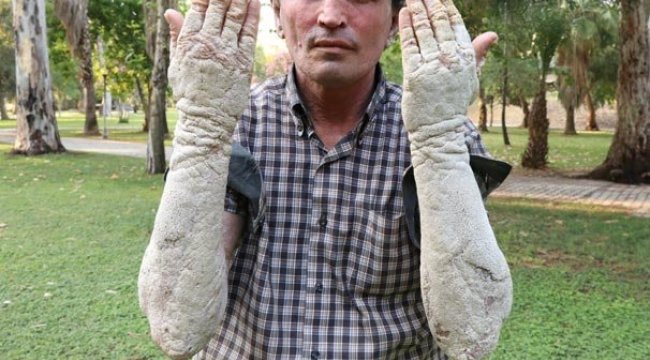 Böyle isyan etti: Beni gören korkup kaçıyor