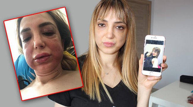 Genç kadın kâbusu yaşadı