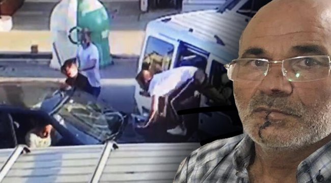 Kayınpederinin dudağını ısırmıştı! Akılalmaz olayda yeni gelişme