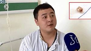 20 Yıl boyunca böyle yaşamış! Bakın diş neresinden çıktı