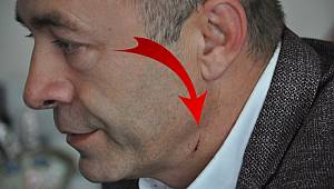 CHP'li Belediye Başkanına Bıçaklı Saldırı!