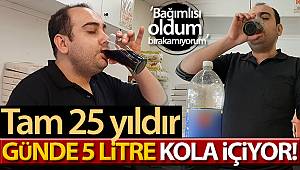 25 yıldır günde 5 litre kola içiyor