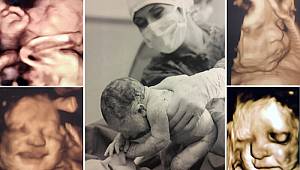 Anne karnındaki bebeklerin gülümseten pozları