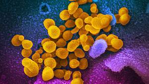 Türkiye ve İran'dan 