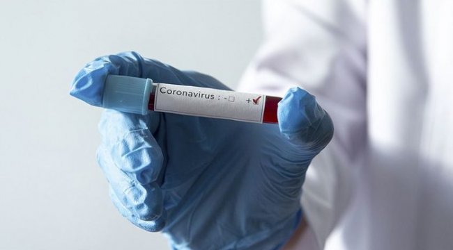 Ankara Üniversitesi koronavirüs aşısı ve tanı kiti için harekete geçiyor
