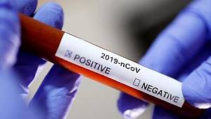 Bilim Kurulu üyesi Kara: Bazı ilaçlar virüse karşı etkili oluyor