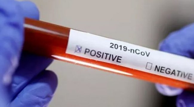İsrail'de koronavirüs vakası 10'a yükseldi