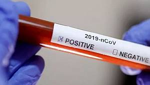 İsrail'de koronavirüs vakası 10'a yükseldi