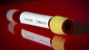 İstanbul'da 24 aile hekimi ile hemşirenin koronavirüs testi pozitif çıktı