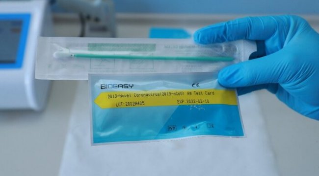Koronavirüsle mücadelede yeni dönem! Virüs testi 15 dakikada sonuç verecek