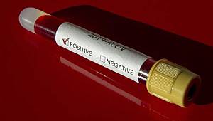 Prof. Dr. Yücel Oğurlu: Koronavirüsü bilerek bulaştıran kasten adam öldürmüş olabilir