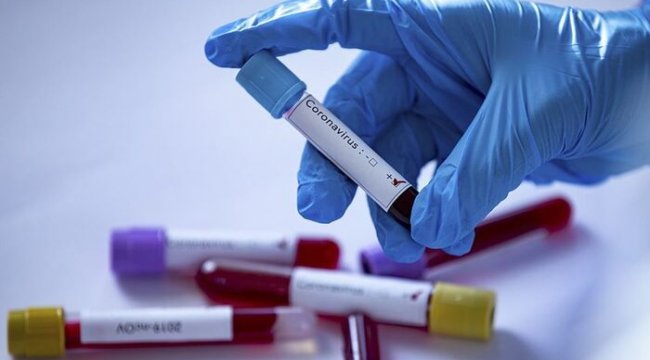Ticaret Bakanlığı personeli koronavirüse yakalandı