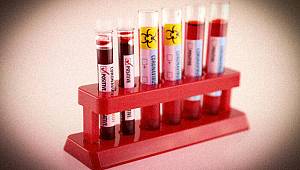 Türkiye’de ve dünyada corona virüsü vaka sayısı kaç oldu? Son dakika koronavirüs haberleri