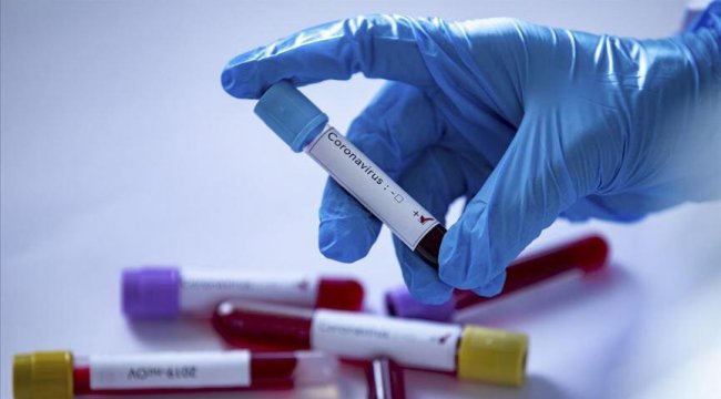 Meclis Hastanesi doktoru, koronavirüs tedavisinden sonra taburcu edildi