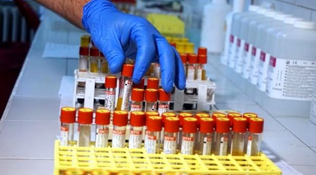 İstanbul Tıp Fakültesi Koronavirüs Laboratuvarında antikor testi yapılmaya başlandı