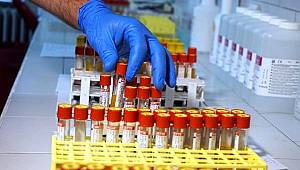 İstanbul Tıp Fakültesi Koronavirüs Laboratuvarında antikor testi yapılmaya başlandı