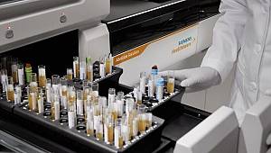 Koronavirüse karşı bağışıklık ölçen test geliştirildi