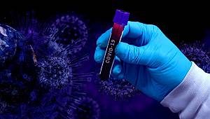 Türkiye'de 150.000 Kişiye Antikor Testi Yapılacak! İşte Sebebi