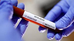 Coronaya yakalanan hastane müdürü yardımcısından acı haber!