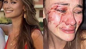 İZMİR ÇEŞME 'DEKİ BEACH CLUB 'TE DÜNYACA ÜNLÜ BAYAN MANKENE DAYAK!'