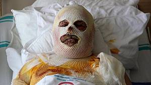 Kahvaltı keyfi korkunç bitti: ‘Bir çay yapalım, dedik olmadı’