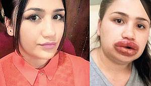 Merdivenaltı Estetik İşlemler Acilde Son Buluyor