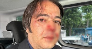 İBB Ekibine Üsküdar'da Saldırı