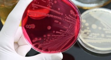 NİJERYA'DA GİZEMLİ HASTALIK