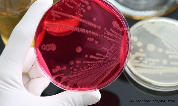 NİJERYA'DA GİZEMLİ HASTALIK