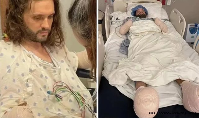 PİRE ISIRIĞI KOCA ADAMI YATAĞA DÜŞÜRDÜ