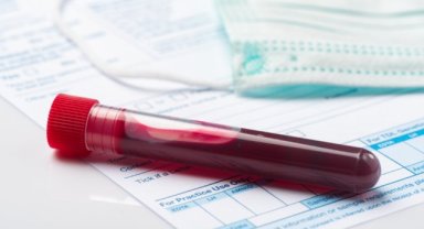 Modern Zamanların Korkulu Rüyası: AIDS