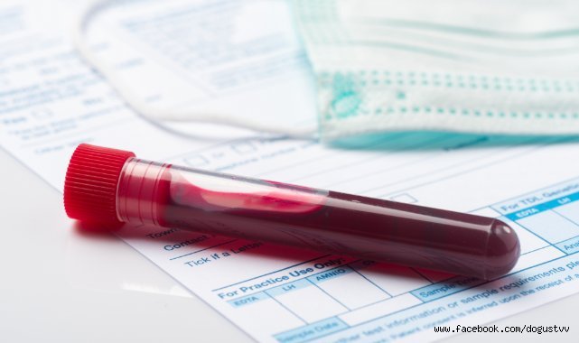 Modern Zamanların Korkulu Rüyası: AIDS