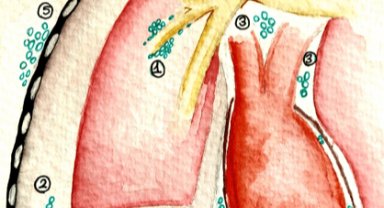 Selen Görgüzel’in kızının rahatsızlığı olan Pnömomediastinum nedir? Nasıl belirti verir? Risk faktörleri nelerdir?