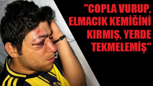 Zihinsel engelli gence polis dayağı