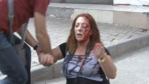 Basın meslek örgütleri Diyarbakır da