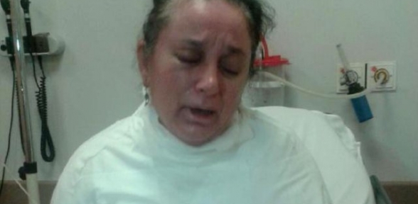 Boşanmak İsteyen Eşinin Üzerine Kaynar Su Döktü