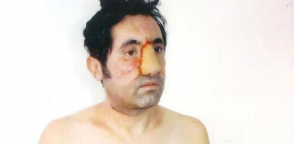 Cezaevinde kaptığı enfeksiyona 200 bin lira tazminat istedi