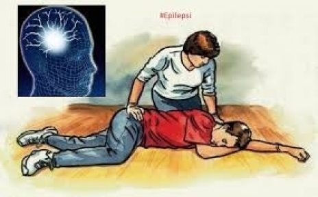 Epilepsi nedir