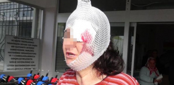 Eşi ve kayınbiraderi bu hale getirdi